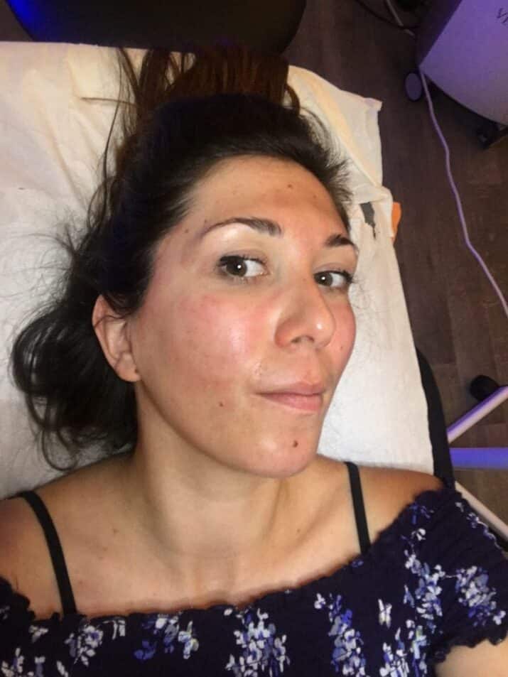 Femme allongée après le soin visage Hydrafacial au Centre Esthétique Aixois